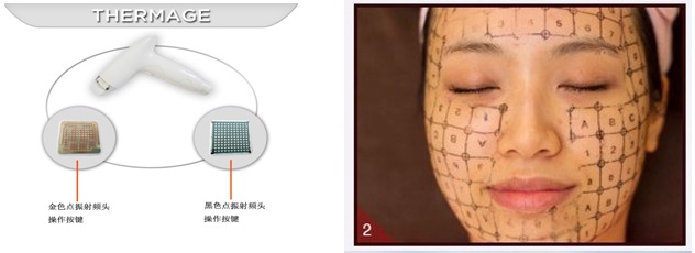 Hai chế độ đặc trị của Máy TRIBOLAR RF THERMAGE