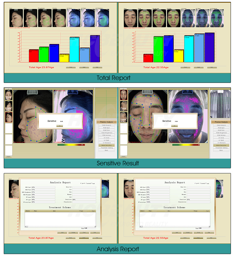 máy phân tích da A one máy phân tích da A one