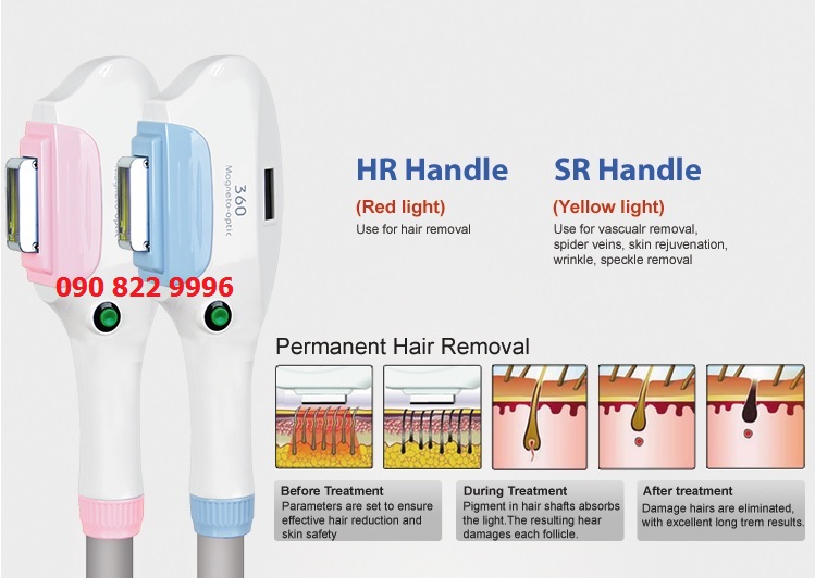 máy triệt lông OPT 2 tay cầm KP-C04